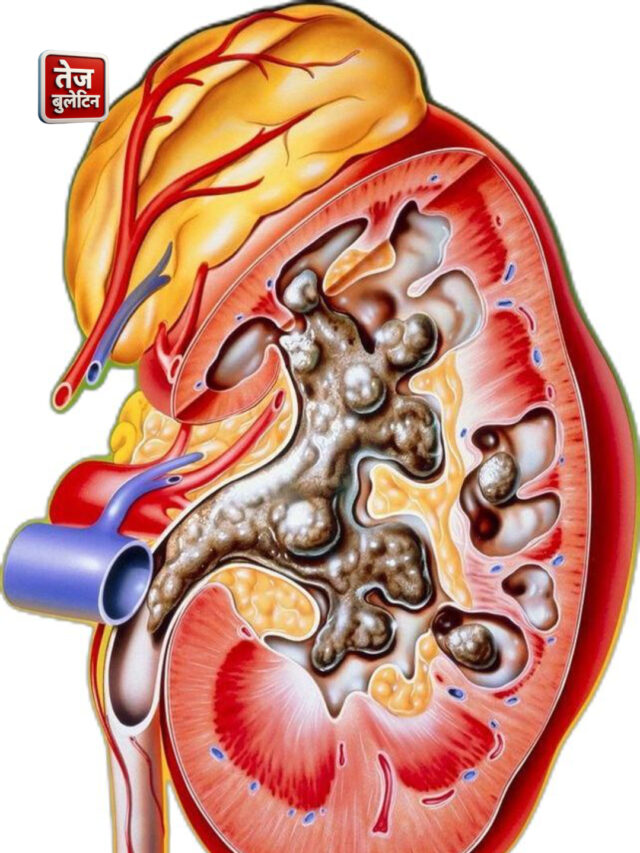 10 Powerful Fruits to Naturally Detox Your Liver and Kidneys